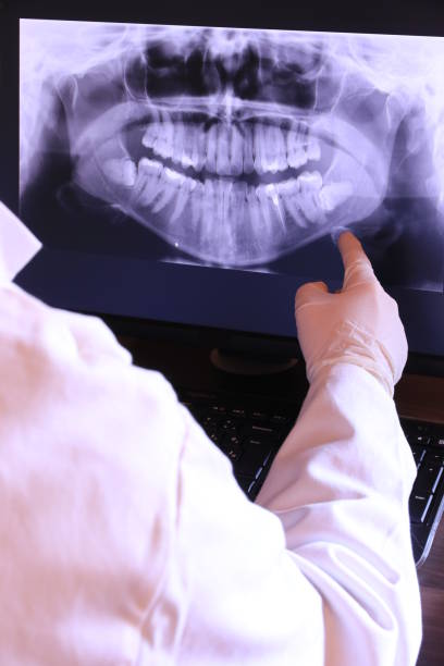 Best Emergency Dentist for Lost Fillings or Crowns in Budd Lake, NJ