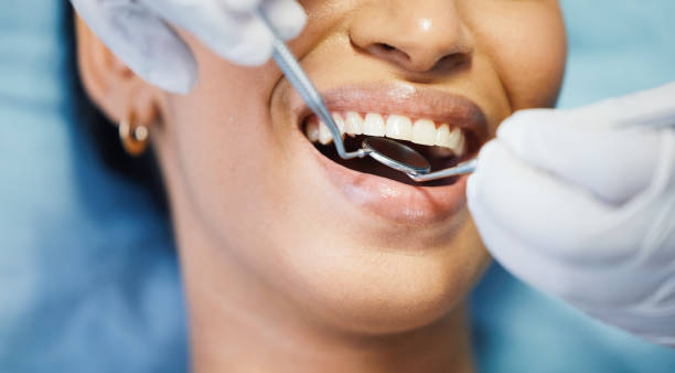 Best Broken or Cracked Tooth Emergency Dentist in Budd Lake, NJ